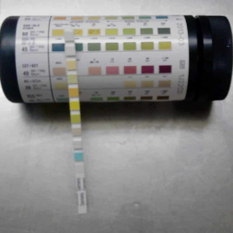 Urine Strips 2 Parameter - Glucose / Protein